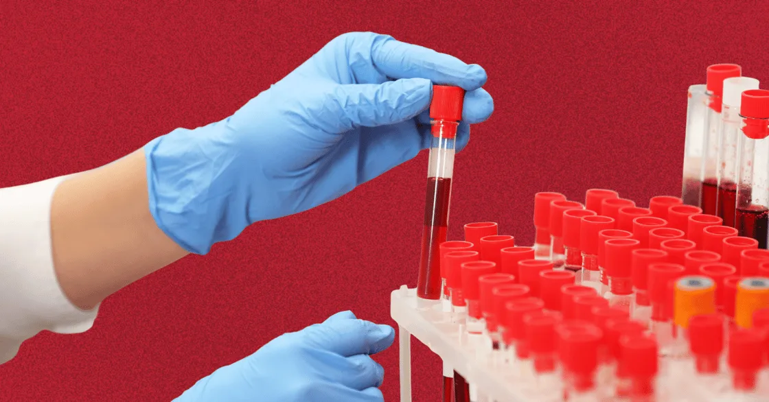 Photo of gloved hands holding a blood sample vial above a rack of red capped test tubes against a red background